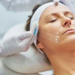 estética avançada em Fortaleza