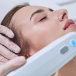 tratamento com ultrassom micro e macrofocado em Fortaleza