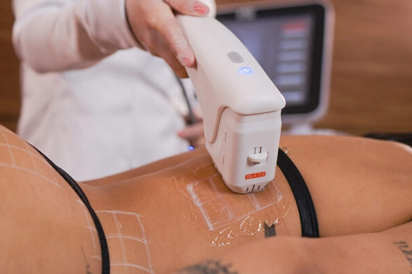 tratamento corporal com ultrassom micro e macro focado