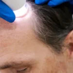 Exame de Tricoscopia em Fortaleza