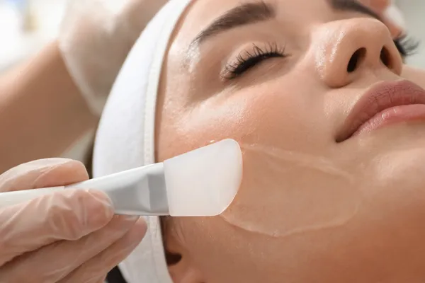 tratamento de melasma com peeling em fortaleza