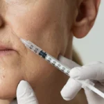 preenchimento de bigode chinês em Fortaleza