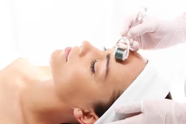 microagulhamento facial para rejuvenescimento em fortaleza