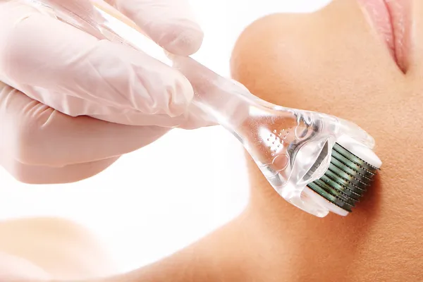 microagulhamento estetica facial fortaleza