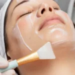peeling quimico em fortaleza