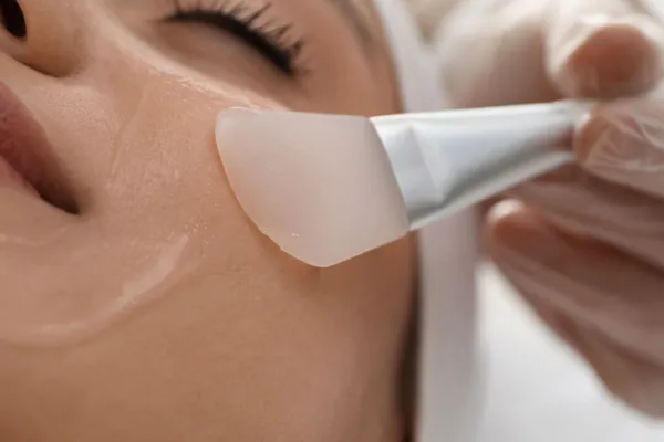 dermatologista para peeling quimico em fortaleza