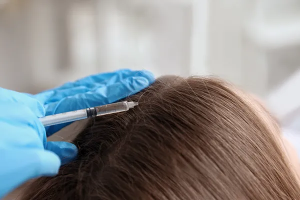 mesoterapia capilar em fortaleza